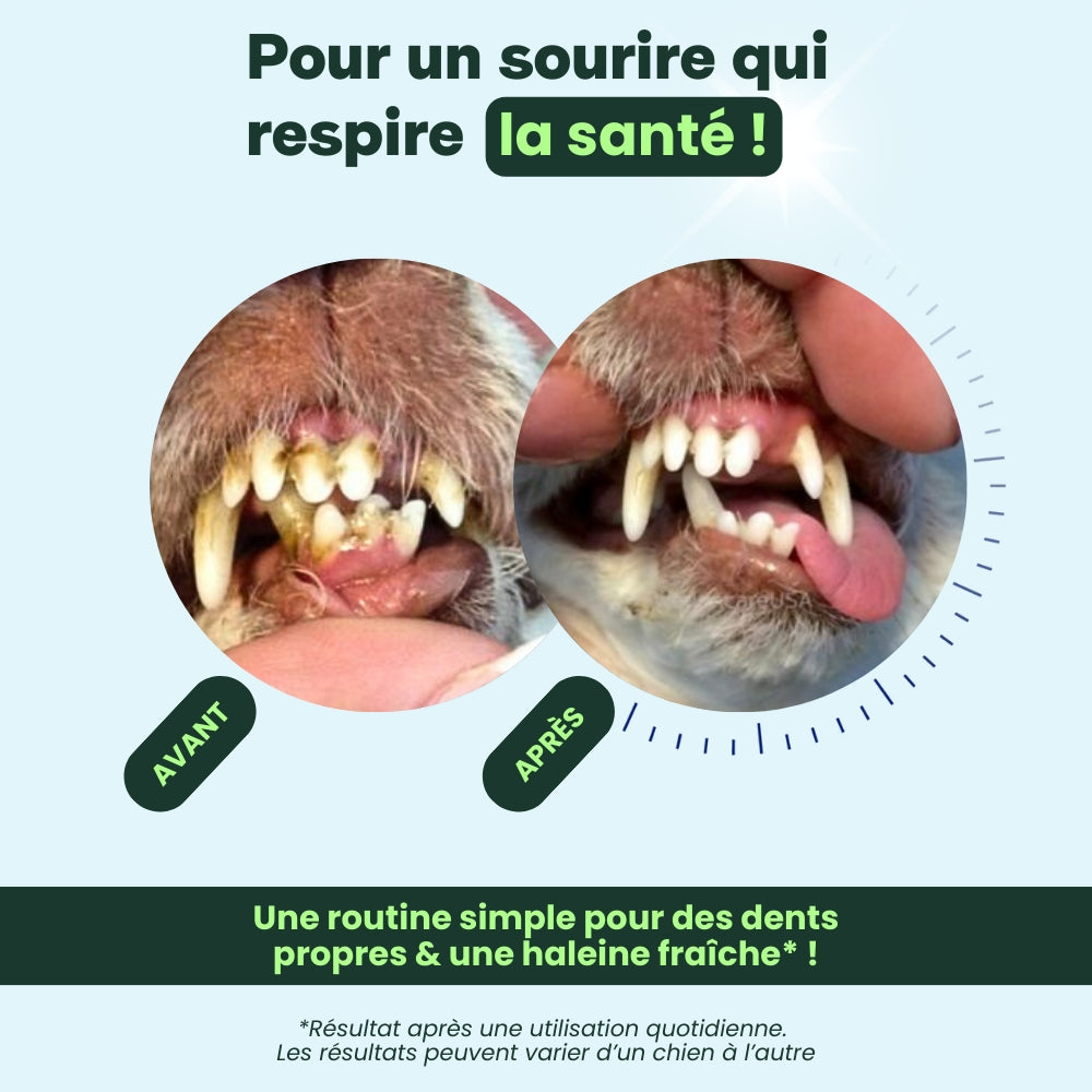 Haleine, Dents & Gencives